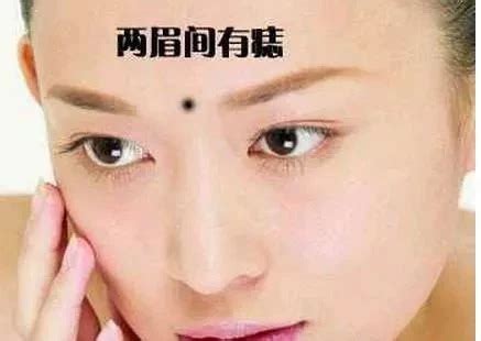 妨夫痣|妨夫痣是什么意思？妨夫痣点掉就化解了吗？